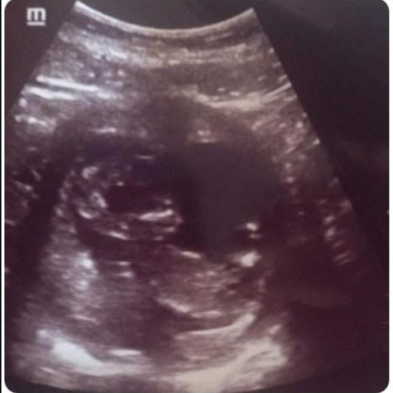 Pregnancy result shared by an anonymous fertility client