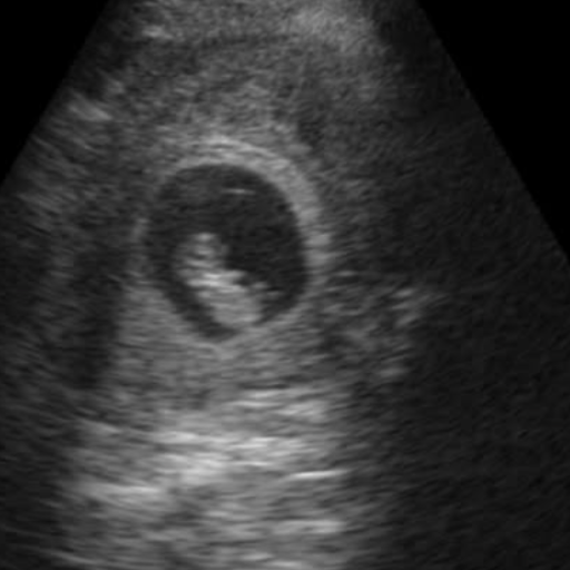 Pregnancy ultrasound shared by Conceev client