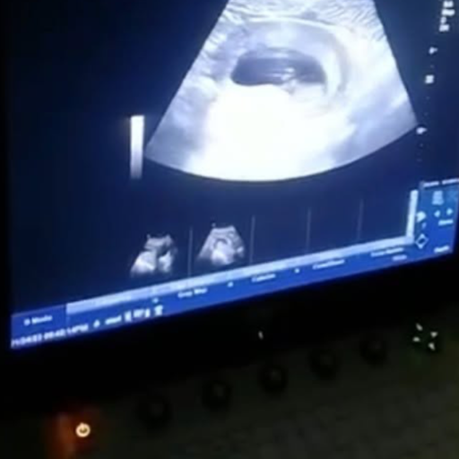 Pregnancy ultrasound shared by Conceev client