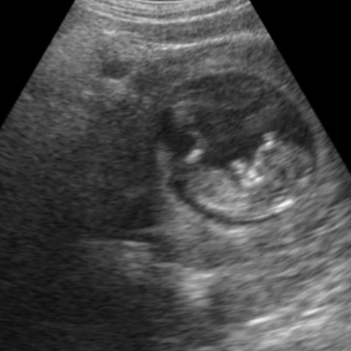 Pregnancy ultrasound shared by Conceev client