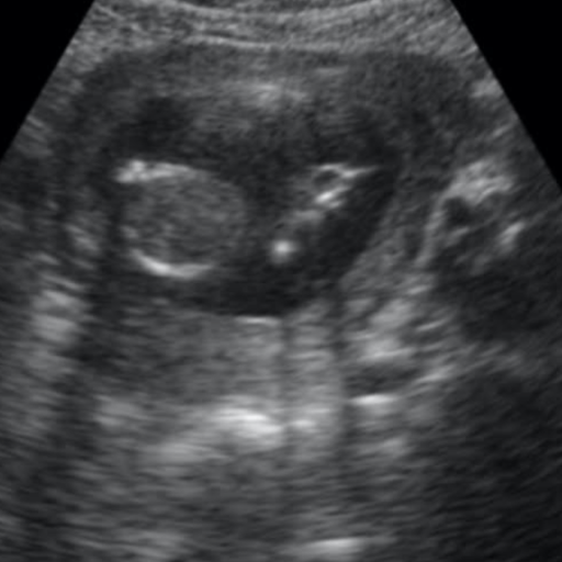 Pregnancy ultrasound shared by Conceev client