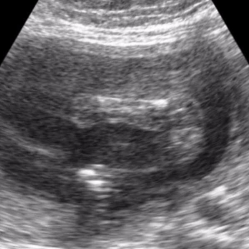 Pregnancy ultrasound shared by Conceev client