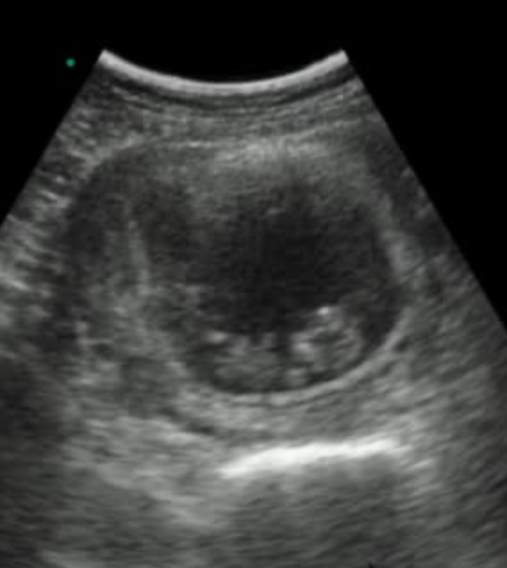 Pregnancy ultrasound shared by Conceev client